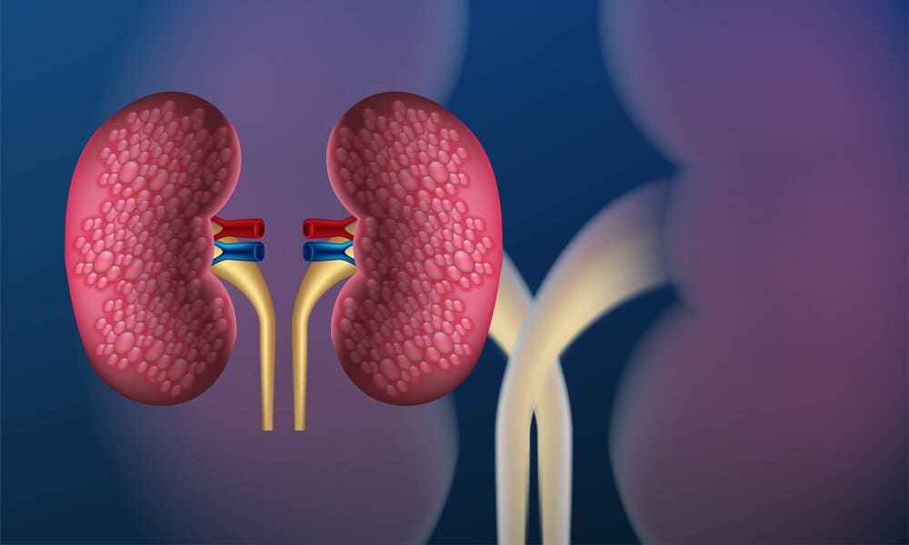 Enfermedad renal crónica